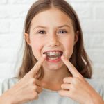 Comfortable and Effective Orthodontic Solutions in Sammamish